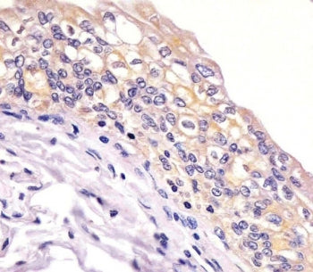 IHC testing of FFPE human bladder tissue with BID antibody. HIER: steam section in pH6 citrate buffe