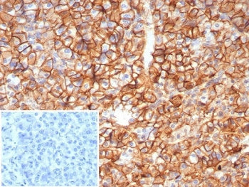 IHC staining of FFPE human pancreas tissue with CD99 antibody (clone MIC2/8119R). Inset: PBS used in