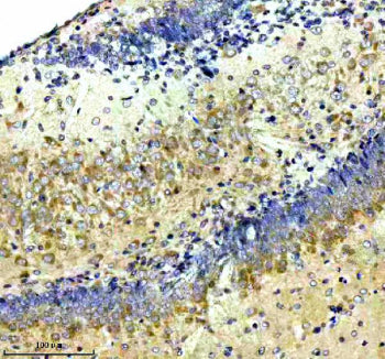 Immunohistochemical staining of NCDN using anti-NCDN antibody. NCDN was detected in a paraffin-embed