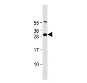 Western blot testing of FAM125A antibody at 1:2000 + human PC-3 cell lysate. Predicted molecular wei