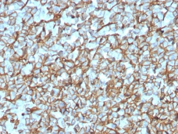 SPTBN2 Antibody / Spectrin beta III