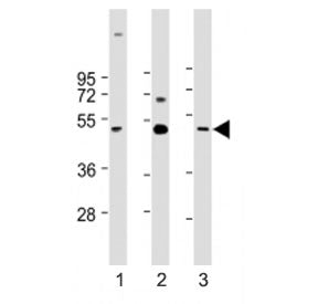 Western blot testing of CX3CL1 antibody at 1:1000: Lane 1) human brain, 2) heart and 3) lung lysate.