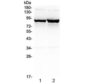 GAT-1 Antibody / GABA Transporter 1 / SLC6A1 (N-Terminal Region)