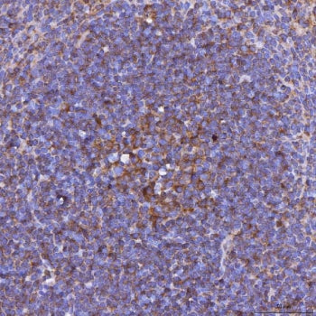 IHC staining of FFPE mouse spleen tissue with Light antibody. HIER: boil tissue sections in pH8 EDTA