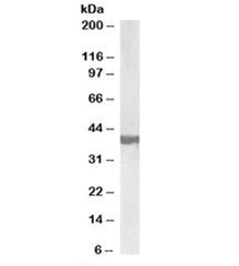Western blot testing of human frontal cortex lysate with SH3GL2 antibody at 0.3ug/ml. Predicted mole