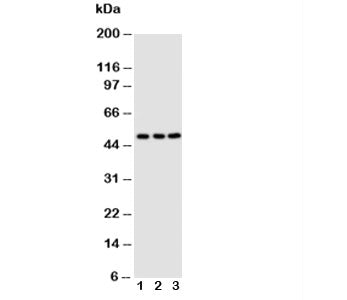 Western blot testing of CXCR4 antibody; Lane 1: M231; 2: MCF-7; 3: Jurkat cell lysate. Predicted mol