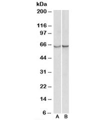 Alpha-1-Antichymotrypsin Antibody