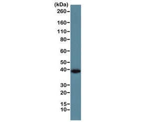 Western blot of human A431 cell lysate using the recombinant GAPDH antibody at 1:1000. Predicted mol