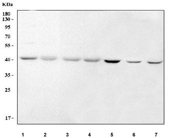 RTCA Antibody / RTCD1