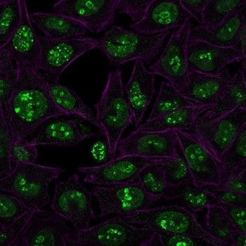 Immunofluorescent staining of human HeLa cells with Ki-67 antibody (green, clone MKI67/2466) and Pha