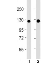 Western blot testing of human 1) A431 and 2) T47D cell lysate with E-Cadherin antibody at 1:4000. Ex