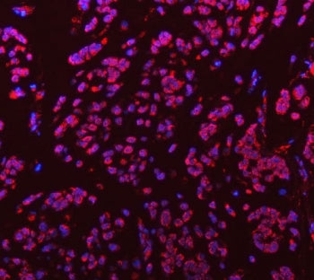 Sm-D3 Antibody / SNRPD3