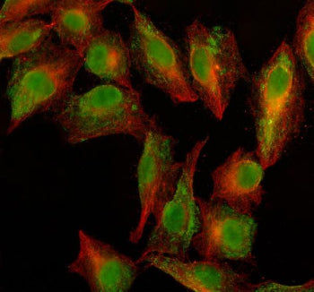 Immunofluorescent staining of PARG using anti-PARG antibody (green) and anti-Beta Tubulin antibody (
