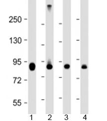 PFKP Antibody / Phosphofructokinase platelet