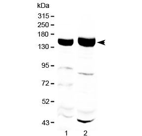 Western blot testing of 1) rat liver and 2) mouse liver with Xanthine Oxidase antibody at 0.5ug/ml.
