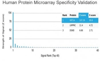 Cytokeratin 14 Antibody / CK14 / KRT14