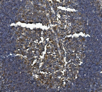 Il-3rb Antibody / Csf2rb / Cd131
