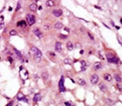 IRAK2 Antibody
