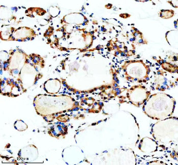 Immunohistochemical staining of MSI2 using anti-MSI2 antibody. MSI2 was detected in a paraffin-embed