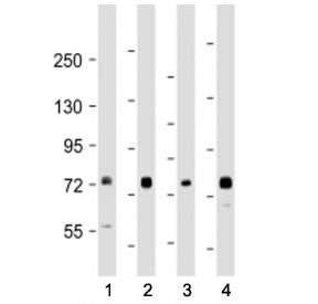 Western blot testing of TAK1 antibody at 1:1000-1:2000: Lane 1) human 293, 2) (h) A431, 3) (h) Raji