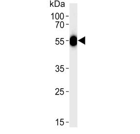 Antithrombin III Antibody