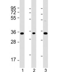 Western blot testing of human 1) K562, 2) THP-1, and 3) HT-1080 cell lysate with TMEM158 antibody at