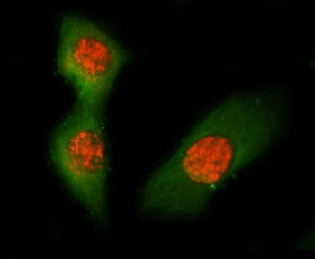 Immunofluorescent staining of FFPE mouse RM-1 cells with Asc antibody (red) and Alpha Tubulin mAb (g