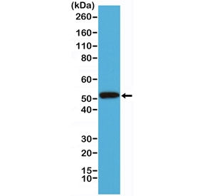 Western blot testing of human A431 cell lysate with recombinant Cytokeratin 14 antibody at 1:1000. P