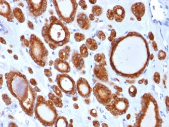 Thyroid Peroxidase Antibody