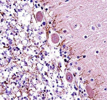 IHC testing of FFPE mouse cerebellum tissue with RAR alpha antibody. HIER: steam section in pH6 citr