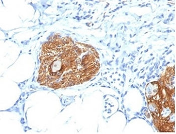 IHC staining of FFPE human pancreas tissue with CD56 antibody (clone 56C04/123A8). HIER: boil tissue