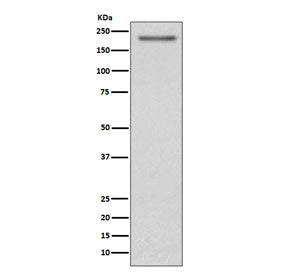 PDGFR alpha Antibody / PDGFRA