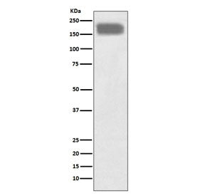 Western blot testing of human SH-SY5Y cell lysate with NCAM1 antibody. Predicted molecular weight: ~
