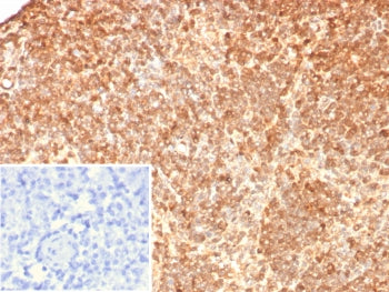 S100G Antibody / Calbindin D9K