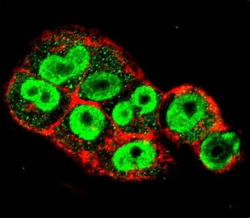 Immunofluorescent staining of fixed and permeabilized human A2058 cells with TIMP-1 antibody (green)