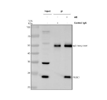 Immunoprecipitating TUSC1 in Hela whole cell lysate. Western blot analysis of TUSC1 using anti-TUSC1