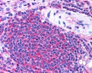 UBASH3A Antibody