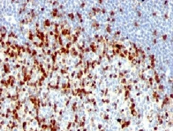 IHC: Formalin-fixed, paraffin-embedded human tonsil stained with ZAP70 antibody (clones ZAP70/528 +