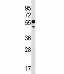 RNF8 antibody western blot analysis in CEM lysate. Predicted molecular weight: 55/51 kDa (isoforms 1