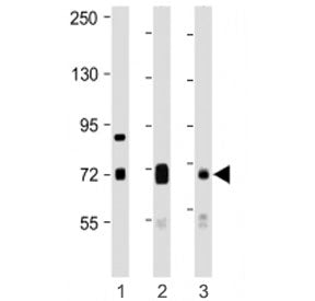 Western blot testing of DLL4 antibody at 1:1000: Lane 1) mouse kidney, 2) mouse lung and 3) rat lung