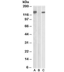 Western blot testing of HEK293 lysate overexpressing human NLRP2/NBS1 with DYKDDDDK tag with NBS1 an