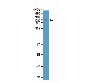 Topoisomerase II alpha Antibody / TOP2A