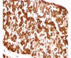 DES / Desmin antibody immunohistochemistry analysis in formalin fixed and paraffin embedded human he