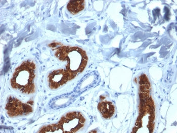IHC staining of FFPE human skin with Cytokeratin 3 antibody (clone KRT3/2130). HIER: boil tissue sec