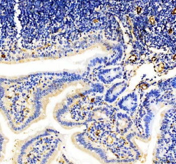 IHC staining of FFPE mouse colon tissue with CD31 antibody. HIER: boil tissue sections in pH8 EDTA f