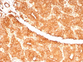 c-RET Antibody