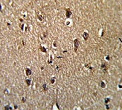 GCAT Antibody / Glycine acetyltransferase