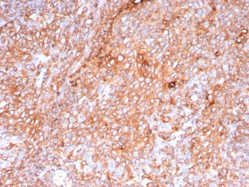 IHC staining of FFPE human tonsil tissue with recombinant HLA-DP/DQ/DR antibody (clone HLA-Pan/9268R