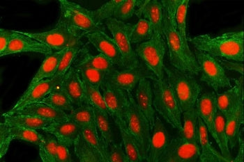 Immunofluorescent staining of FFPE human U-2 OS cells with SAE1 antibody (red) and Alpha Tubulin mAb