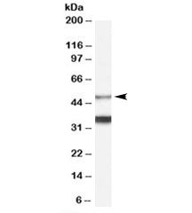 Western blot testing of human brain lysate with Orexin receptor antibody at 0.1ug/ml. Predicted mole